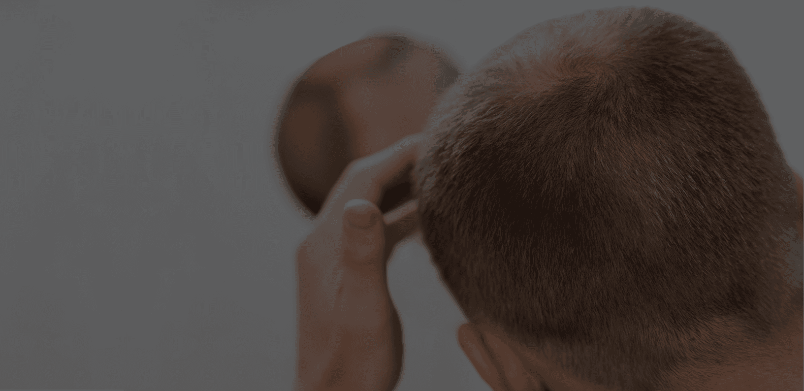 hair-loss-banner