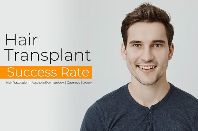 Hair Transplant Success Rates &#8211; A Comprehensive Guide by India&#8217;s Best Surgeons