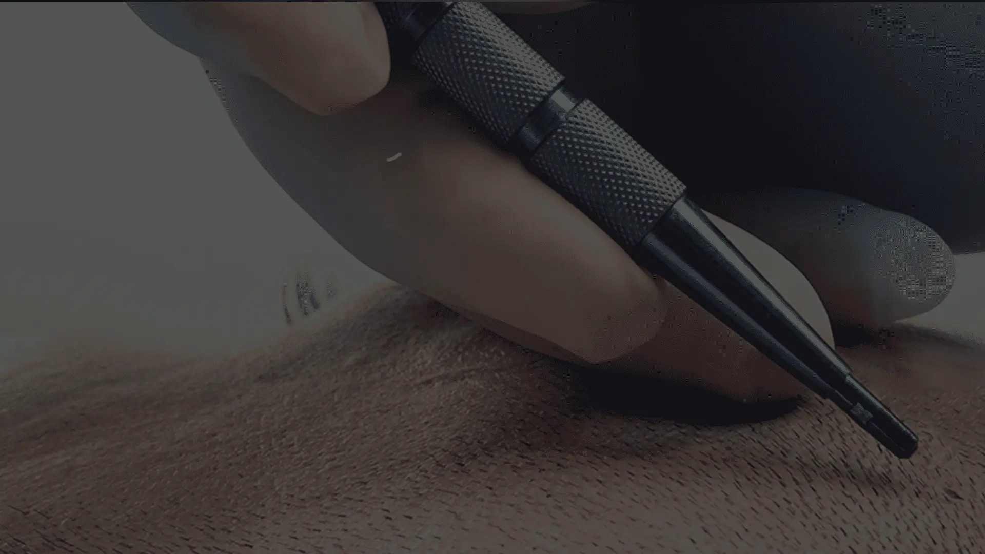 sapphire fue hair transplant in India