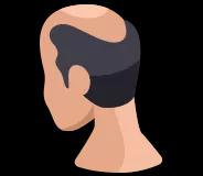 Hair Loss Treatment in Delhi