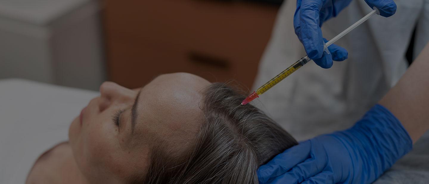 prp-treatment