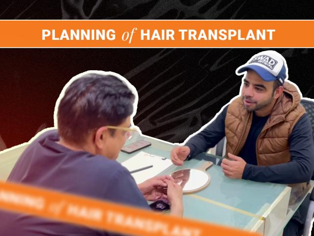 Planning a Hair Transplant? Avoid These Common Mistakes for Safe, Natural Results
