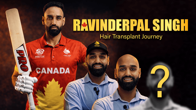 ravinderpal singh hair transplant