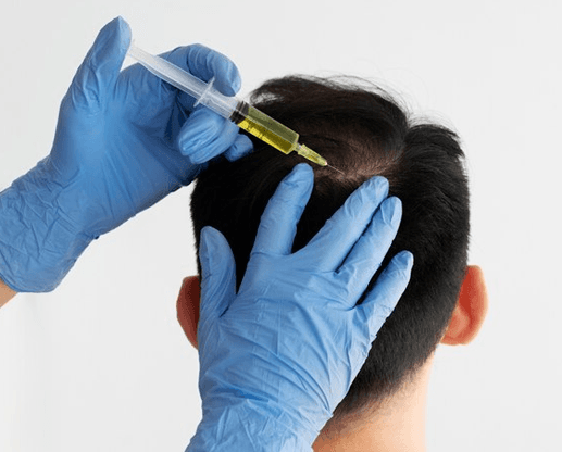 PRP-Therapy
