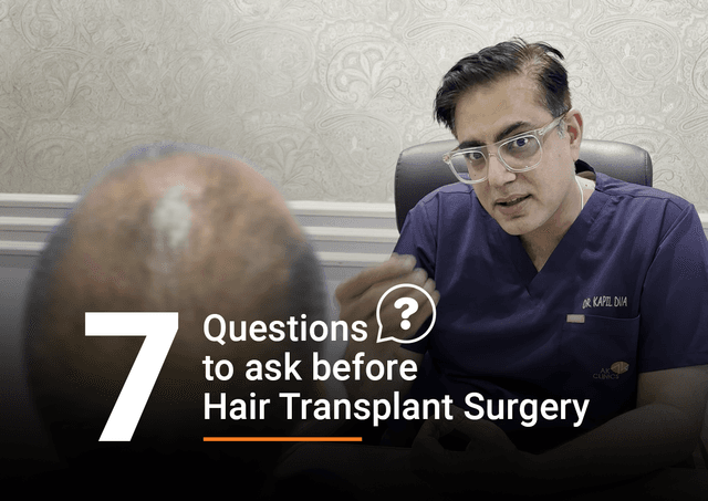 7 Questions to Ask Before Hair Transplant Surgery